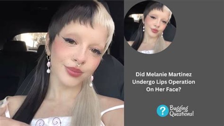 Did Melanie Martinez Undergo Plastic Surgery?