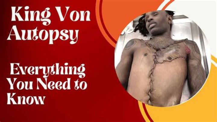 King Von Autopsy PDF Reveals Surprising Findings