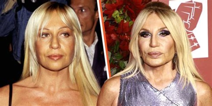Smokey Robinson's Plastic Surgery: Uncovering The Truth